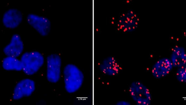 ep celulas de un neuroblastoma los puntos rojos marcan los sitios donde la proteina brca1 ocurre en