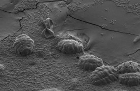 ep tardigrados