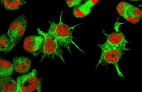 ep vista al microscopio de celulas de neuroblastoma