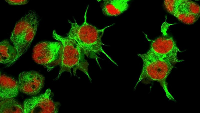 ep vista al microscopio de celulas de neuroblastoma ep vista al microscopio de celulas de neuroblastoma