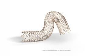 fortegra venous stent 20260609071013 
