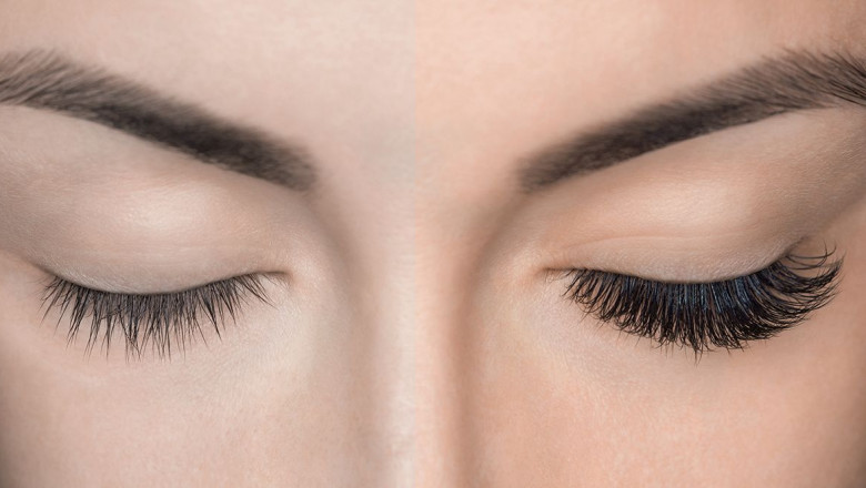 1568809698 esteticagrandaes