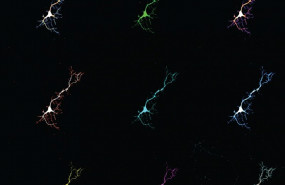 ep collagecelulas neuronales utilizadaseste estudio las neuronasexpresanproteinafluoresceunirsela bilirrubina