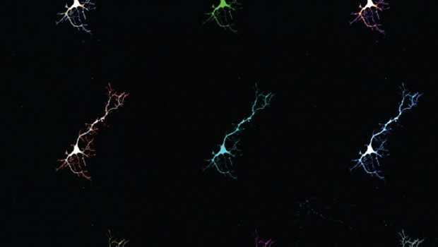 ep collagecelulas neuronales utilizadaseste estudio las neuronasexpresanproteinafluoresceunirsela bilirrubina