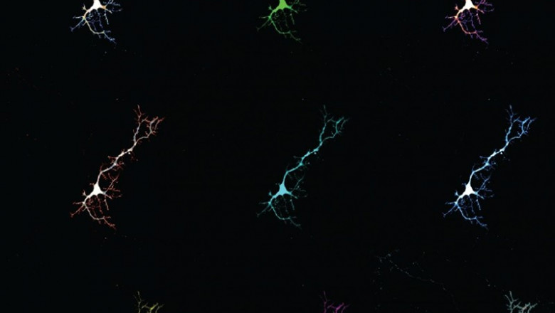 ep collagecelulas neuronales utilizadaseste estudio las neuronasexpresanproteinafluoresceunirsela bilirrubina