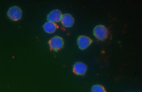 ep linfocitos b azulverde y nanoparticulasoro rojo medidasimagenes hiperespectralescampo oscurodeteccion fluorescente