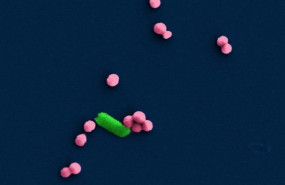 ep bacterias e coli en formabarra y staphylococcus aureus esferica