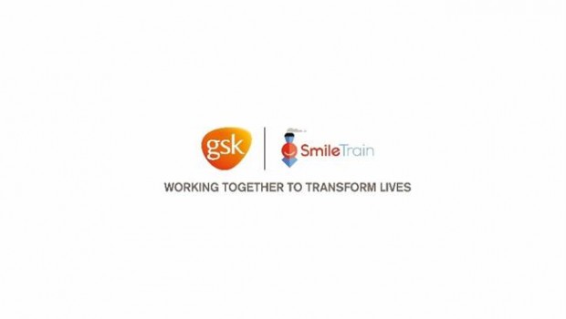 ep colaboraciongsksmile trainninosfisura labiopalatina