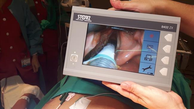 Monitorización de los nervios laríngeos recurrentes | QUIRÓNSALUD ep monitorizacionlos nervios laringeos recurrentes