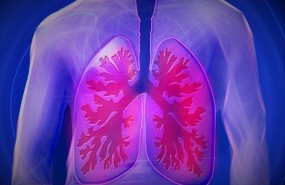 ep pulmones epoc