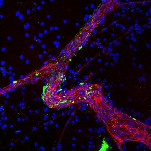 Un gran vaso sanguíneo (rojo) en tejido cerebral tratado con exosomas derivados de células metastásicas cerebrales (verde), | GONÇALO RODRIGUES Y EL DR. DAVID LYDEN ep un gran vaso sanguineo rojo en tejido cerebral tratado con exosomas derivados de celulas