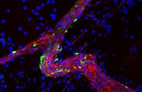 ep un gran vaso sanguineo rojo en tejido cerebral tratado con exosomas derivados de celulas