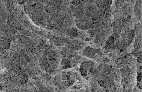 ep imagen de microscopia articulo sobre rigidez matriz extracelular tumoral de ezequiel monferrer