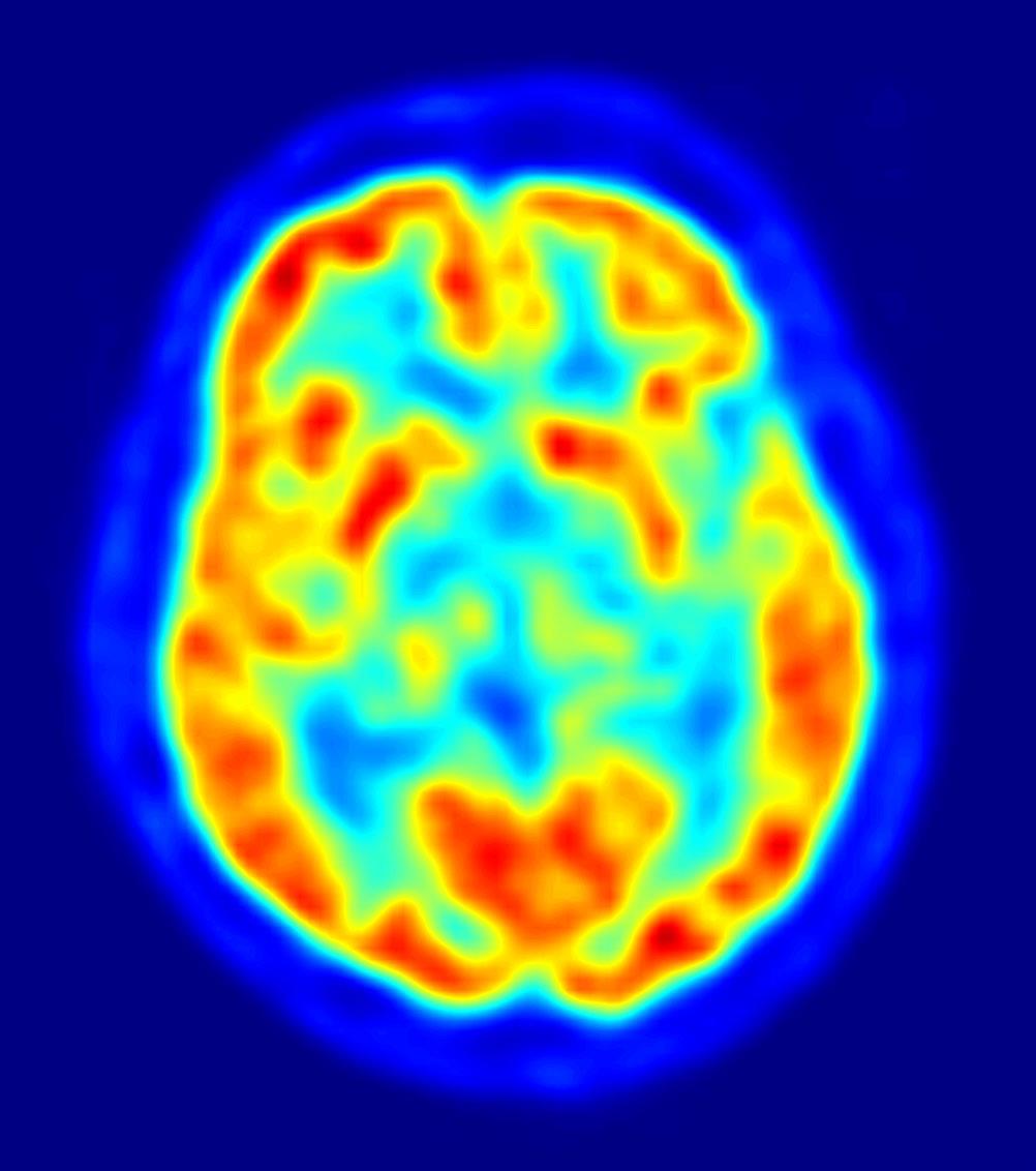 cerebro, recurso, neuronas | JENS LANGNER - Archivo ep cerebro recurso neuronas