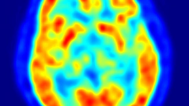 ep cerebro recurso neuronas