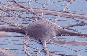 ep investigadoresla facultadmedicinala universidadcaliforniasan diego estados unidos han creado con exito celulas madre neuronalesla medula espinal nsc a partircelulas madre pluripotentes humanas hpsc porsiglasin