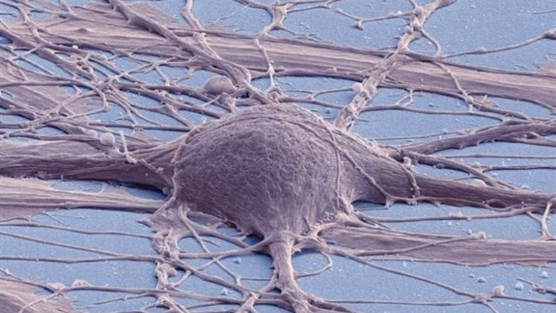 ep investigadoresla facultadmedicinala universidadcaliforniasan diego estados unidos han creado con exito celulas madre neuronalesla medula espinal nsc a partircelulas madre pluripotentes humanas hpsc porsiglasin