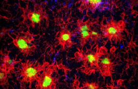 ep la microglia quemuestrarojo rodeareaccionalas placas beta amiloides quemuestranverde encerebroenfermedadalzheimer
