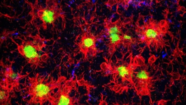 ep la microglia quemuestrarojo rodeareaccionalas placas beta amiloides quemuestranverde encerebroenfermedadalzheimer