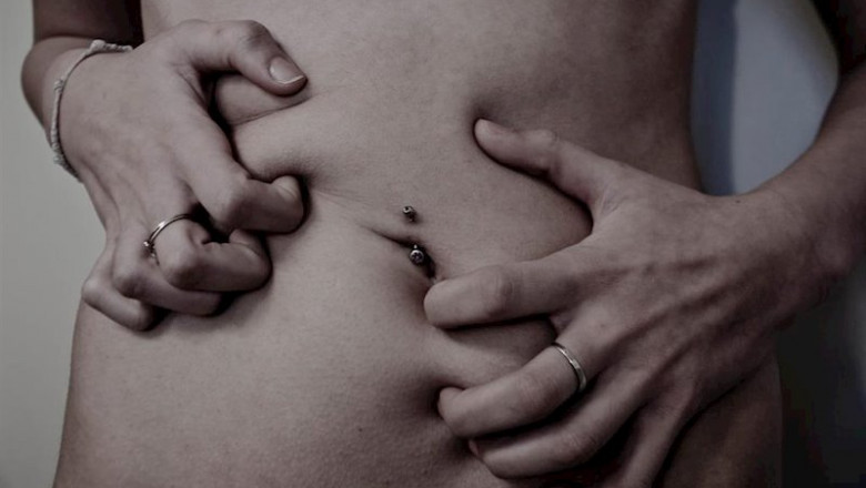 ep imagen anorexia ep imagen anorexia