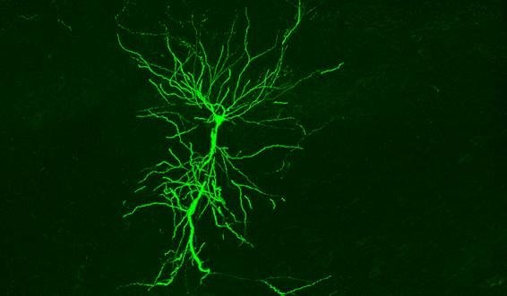 ep celula piramidal del hipocampo captada in vivo