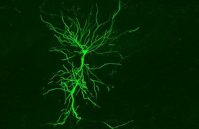 ep celula piramidal del hipocampo captada in vivo
