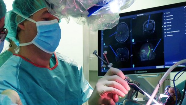 ep neuronavegador